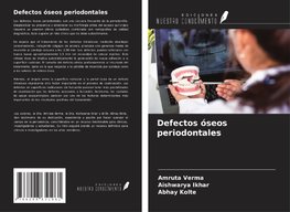 Defectos óseos periodontales
