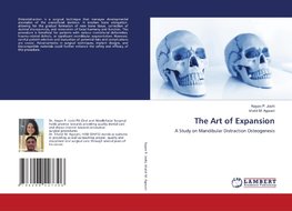 The Art of Expansion