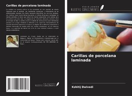 Carillas de porcelana laminada