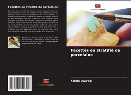 Facettes en stratifié de porcelaine