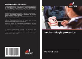Implantologia protesica