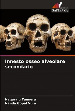 Innesto osseo alveolare secondario