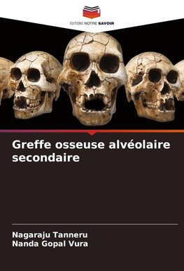 Greffe osseuse alvéolaire secondaire
