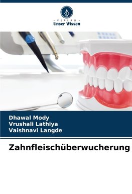 Zahnfleischüberwucherung