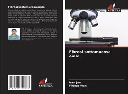 Fibrosi sottomucosa orale