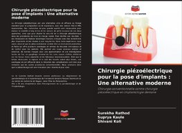 Chirurgie piézoélectrique pour la pose d'implants : Une alternative moderne