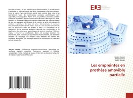 Les empreintes en prothèse amovible partielle