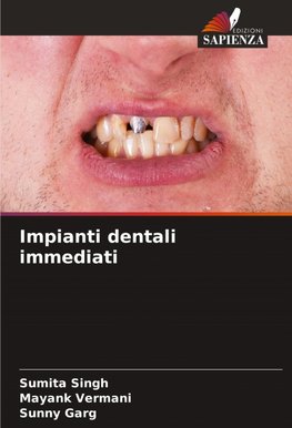 Impianti dentali immediati