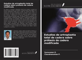Estudios de artroplastia total de cadera sobre prótesis de cadera modificada
