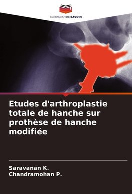 Etudes d'arthroplastie totale de hanche sur prothèse de hanche modifiée