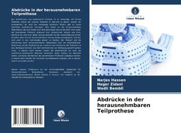 Abdrücke in der herausnehmbaren Teilprothese