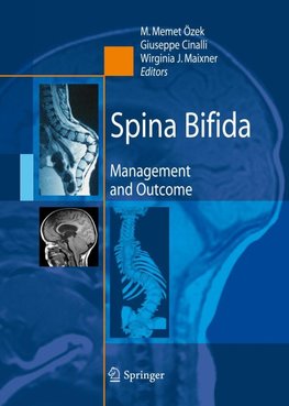 Spina Bifida