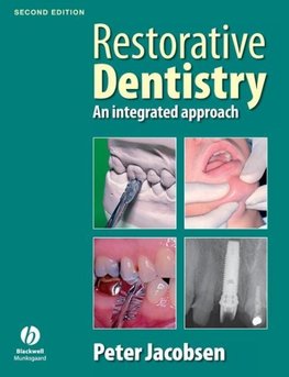 Restorative Dentistry 2e