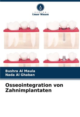 Osseointegration von Zahnimplantaten