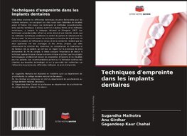 Techniques d'empreinte dans les implants dentaires