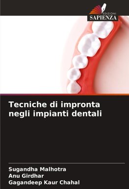 Tecniche di impronta negli impianti dentali