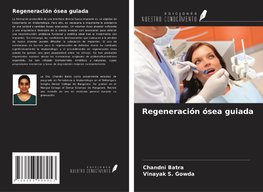 Regeneración ósea guiada