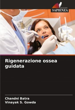 Rigenerazione ossea guidata