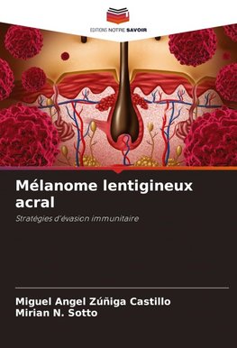 Mélanome lentigineux acral