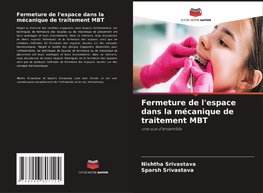 Fermeture de l'espace dans la mécanique de traitement MBT