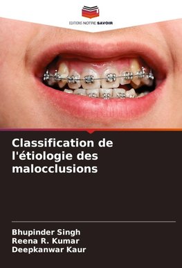 Classification de l'étiologie des malocclusions