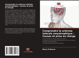 Comprendre la sclérose latérale amyotrophique : Causes et prise en charge