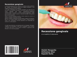 Recessione gengivale