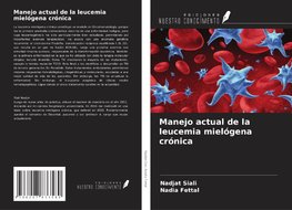 Manejo actual de la leucemia mielógena crónica