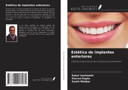 Estética de implantes anteriores