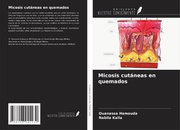 Micosis cutáneas en quemados