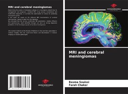 MRI and cerebral meningiomas
