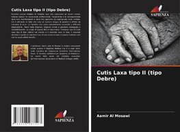 Cutis Laxa tipo II (tipo Debre)
