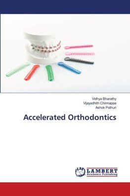 Accelerated Orthodontics