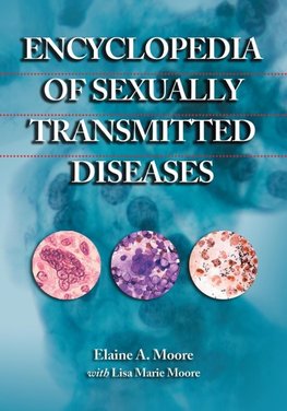 Encyclopedia of Sexually Transmitted Diseases