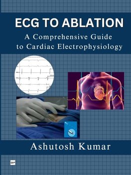 ECG TO ABLATION