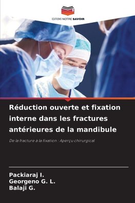 Réduction ouverte et fixation interne dans les fractures antérieures de la mandibule