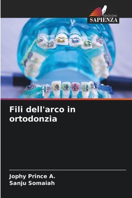 Fili dell'arco in ortodonzia