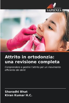 Attrito in ortodonzia: una revisione completa