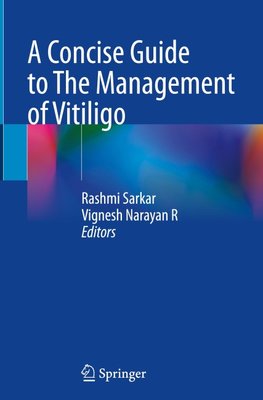 A Concise Guide to The Management of Vitiligo