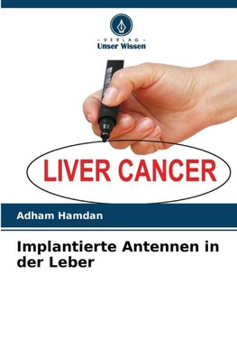 Implantierte Antennen in der Leber