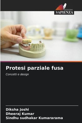 Protesi parziale fusa