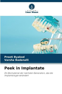 Peek in Implantate