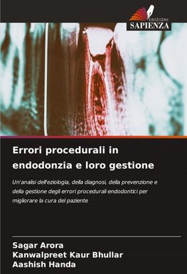 Errori procedurali in endodonzia e loro gestione