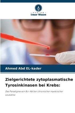 Zielgerichtete zytoplasmatische Tyrosinkinasen bei Krebs: