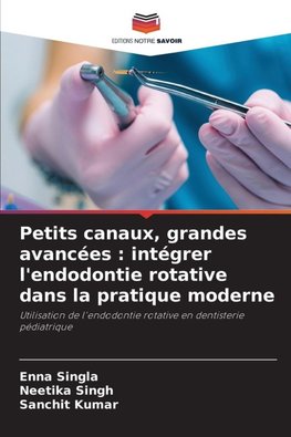Petits canaux, grandes avancées : intégrer l'endodontie rotative dans la pratique moderne