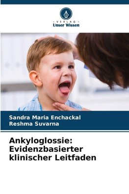 Ankyloglossie: Evidenzbasierter klinischer Leitfaden
