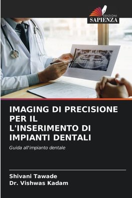 IMAGING DI PRECISIONE PER IL L'INSERIMENTO DI IMPIANTI DENTALI