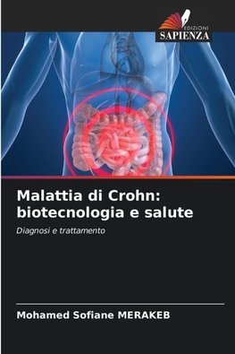 Malattia di Crohn: biotecnologia e salute