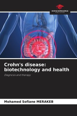 Crohn's disease: biotechnology and health