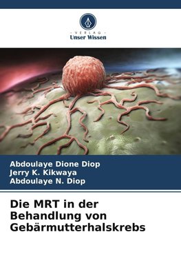 Die MRT in der Behandlung von Gebärmutterhalskrebs